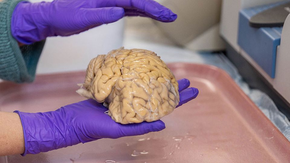 EliteAger brain comparison